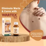 Medisynth Wartex Forte Oral Drops for Warts and Corns 30ml by Dava Global