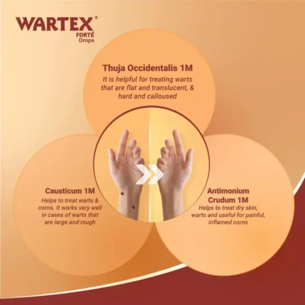 Medisynth Wartex Forte Oral Drops for Warts and Corns 30ml by Dava Global
